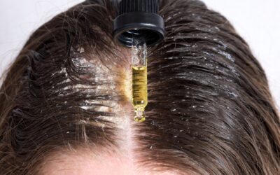 Scalp Health Oils: Abyssinian Oil vs Coconut Oil for Deep Repair